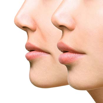 model downturned mouth