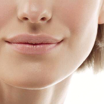 Marionette line filler model